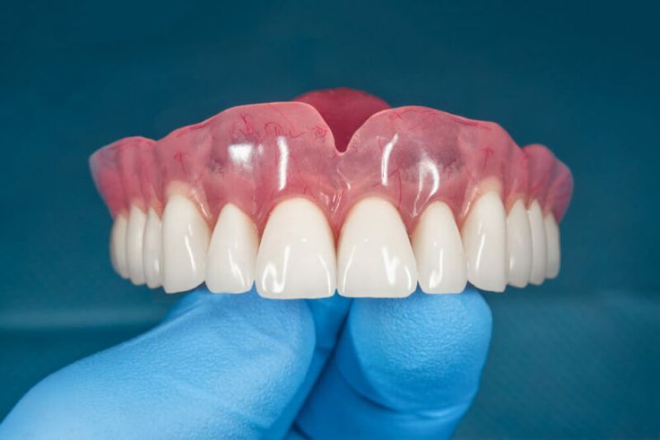 Denture consultation